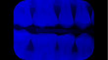 lostdoor_teeth.png GrayscaleBlue