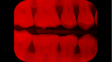lostdoor_teeth.png GrayscaleRed