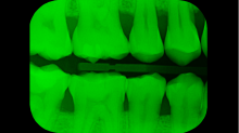 lostdoor_teeth.png GrayscaleGreen