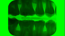 lostdoor_teeth.png InvertGBRGreen